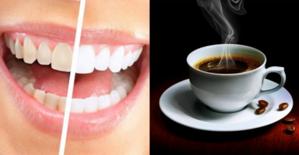 Окрашивание зубов кофе. Белоснежные зубы и кофе. Зубы и чай. После кофе во рту