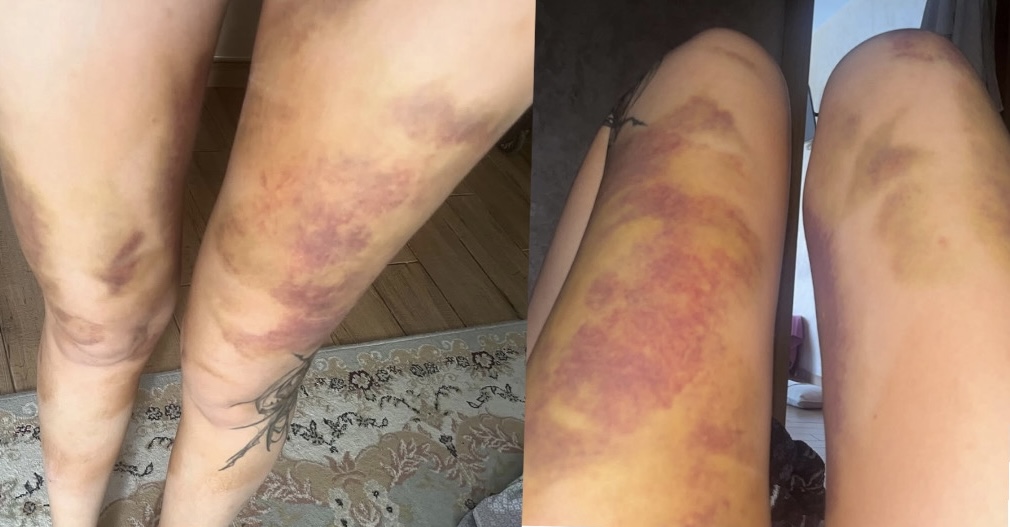 Бас мұғалім мені ұрды